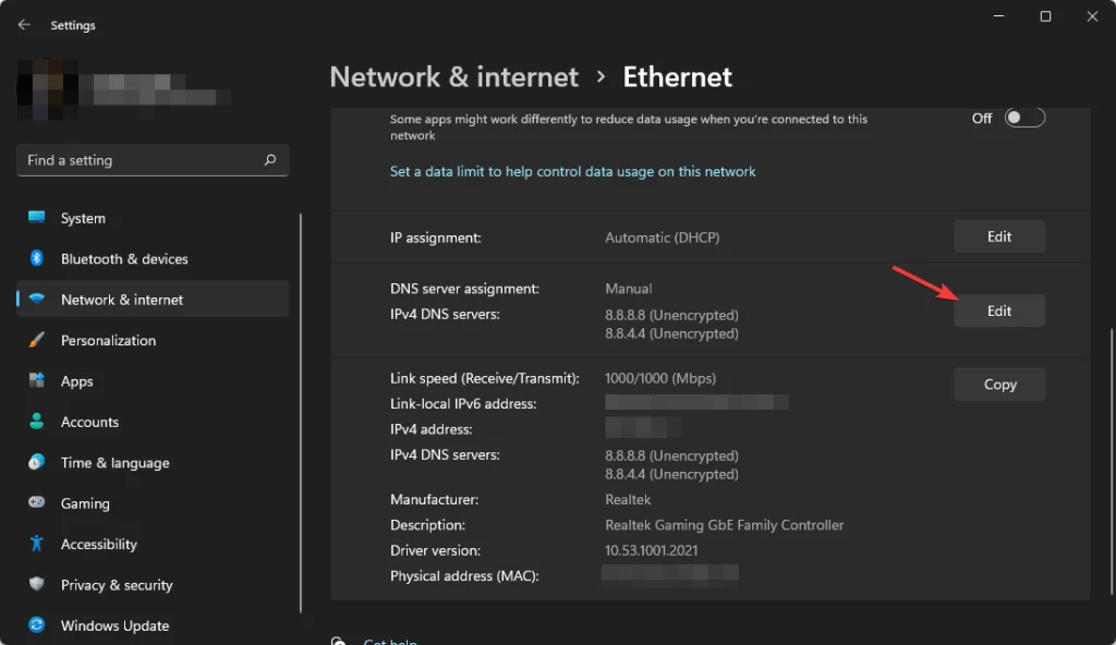 edit dns server assignment