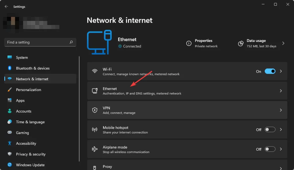 ethernet settings